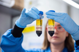 وزیر بهداشت استرالیا: واکسن کرونا ماه مارس در دسترس است