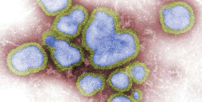 ۱۱ هزار مبتلا؛ فصل آنفلوانزا در نیوساوت‌ولز زودتر آغاز شد