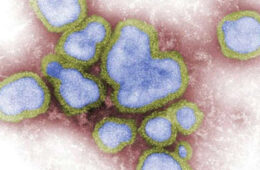 ۱۱ هزار مبتلا؛ فصل آنفلوانزا در نیوساوت‌ولز زودتر آغاز شد